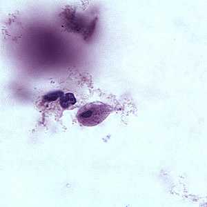 Figure C