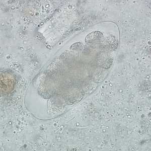 Figure D