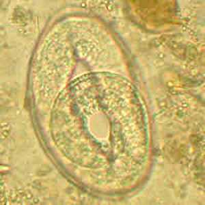 Figure C