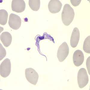 Trypanosomiasis, African