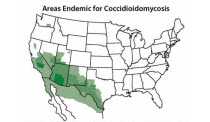 Valley fever fungus (Coccidioides) US exposure map