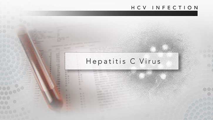 HCV
