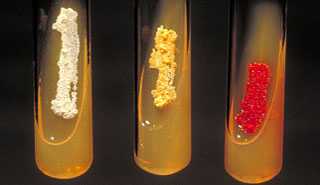 Each year lab scientists in the Special Bacteriology Reference Laboratory (SBRL) identify 4-5 new species of bacteria. 