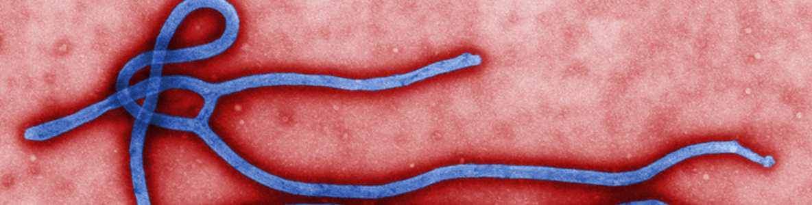 Colorized transmission electron micrograph (TEM) of ebola virus virion