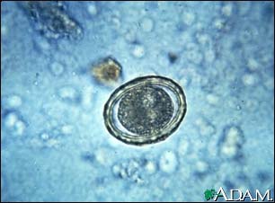 Roundworm eggs - ascariasis Roundworm eggs - ascariasis