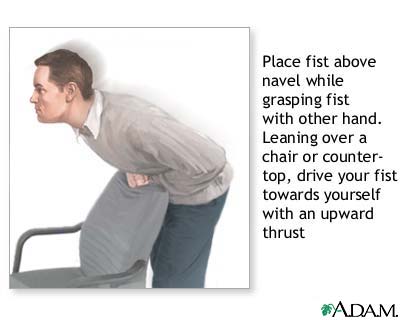 Heimlich maneuver on oneself Heimlich maneuver on oneself