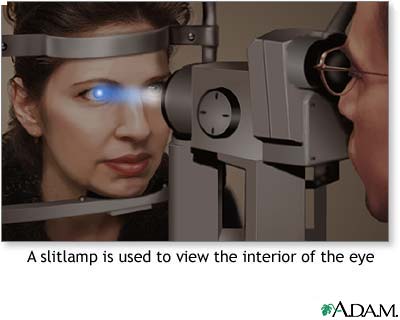 Slit-lamp exam Slit-lamp exam