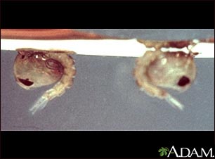 Mosquito, pupa Mosquito, pupa