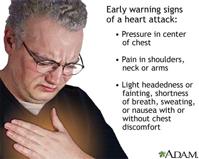 Heart attack symptoms Heart attack symptoms