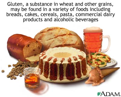 Celiac sprue - foods to avoid Celiac sprue - foods to avoid