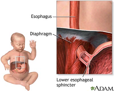 Baby spitting up Baby spitting up