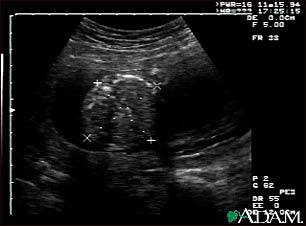 Ultrasound, normal fetus - abdomen measurements Ultrasound, normal fetus - abdomen measurements