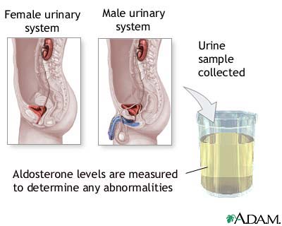Aldosterone level test Aldosterone level test