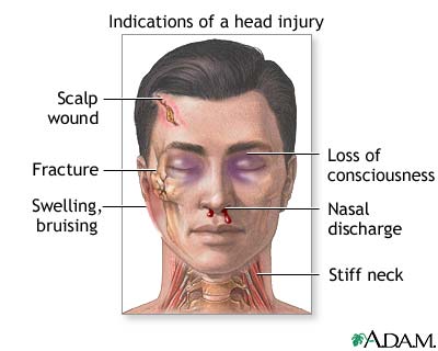 Indications of head injury Indications of head injury