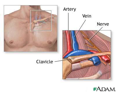 Thoracic outlet anatomy Thoracic outlet anatomy