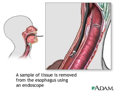 Esophageal tissue culture Esophageal tissue culture