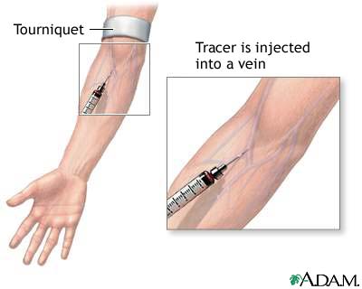 Gallbladder radionuclide scan Gallbladder radionuclide scan