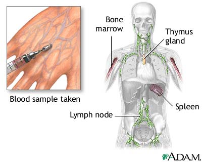 Nitroblue tetrazolium test Nitroblue tetrazolium test