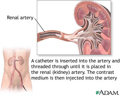 Renal arteries Renal arteries