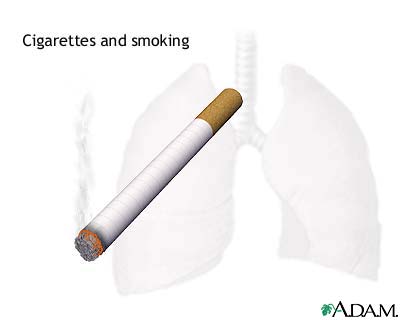 Smoking hazards Smoking hazards