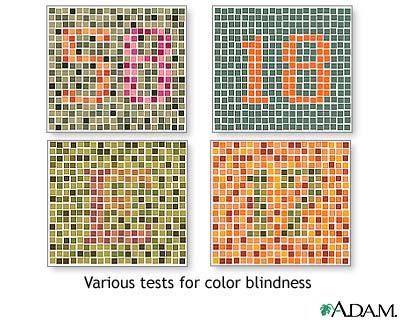 Color blindness tests Color blindness tests