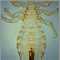 Body louse
